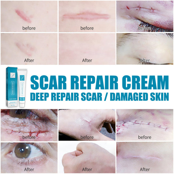 Smooth Skin Solution Cream