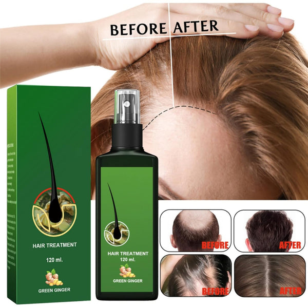 Ginger Hair Growth Magic