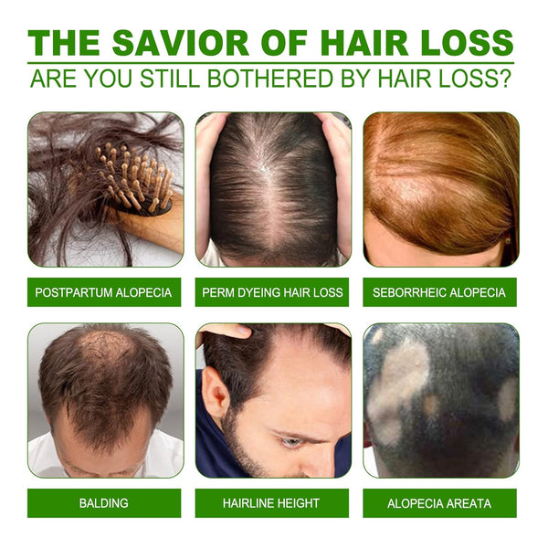 Ginger Hair Growth Magic