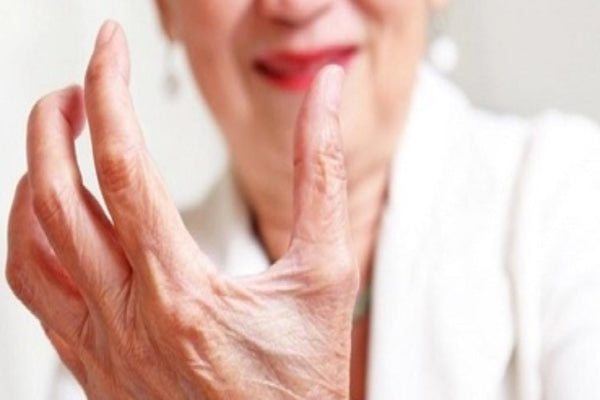 How do you manage arthritis?