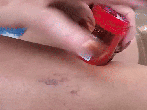 Varicose Veins Relief Cream - Promote blood return