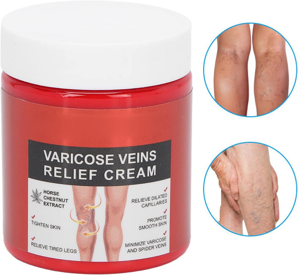 Vein Relief Cream
