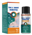 Tag & Wart Remover Treatment (70% OFF)